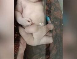 Viral! se-Indonesia! Wanita Ini Melahirkan Bayi Berkaki 6, Setelah Dicek Dokter, Ternyata